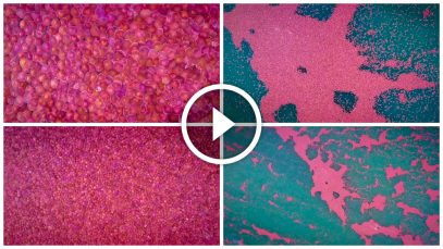 Thousands of Pink Jellyfish in the El Nido, Palawan, Philippines Project LUPAD